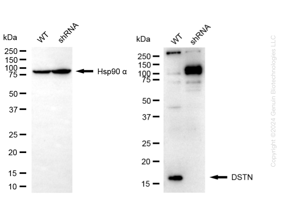 Destrin (DSTN) Human Knockdown Lysate | LY300470 | OriGene Technologies ...