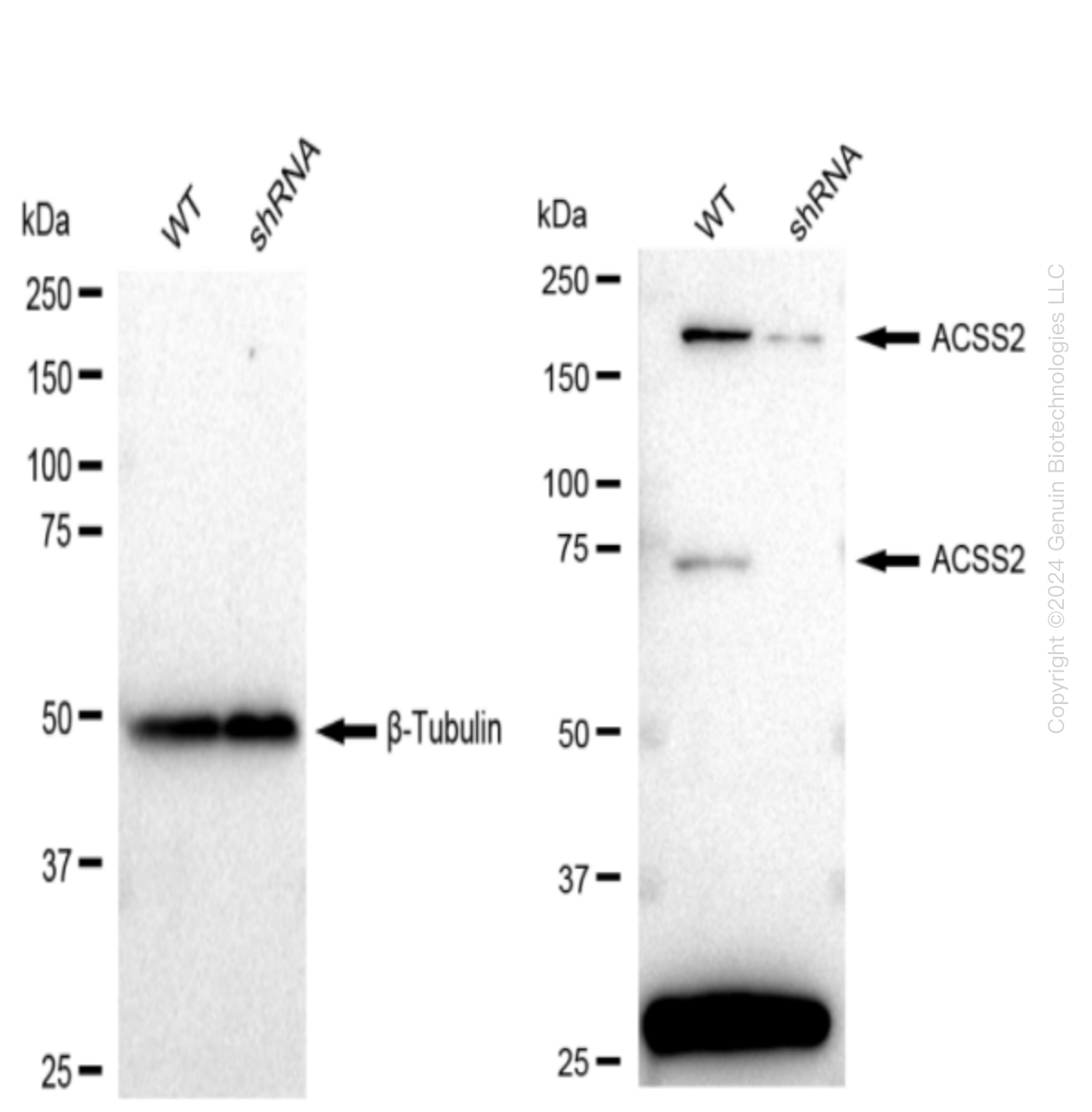 Acetyl CoA synthetase (ACSS2) Human Knockdown Lysate | LY300473 ...