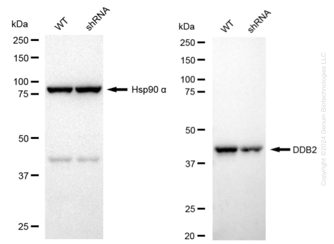 DDB2 Human Knockdown Lysate