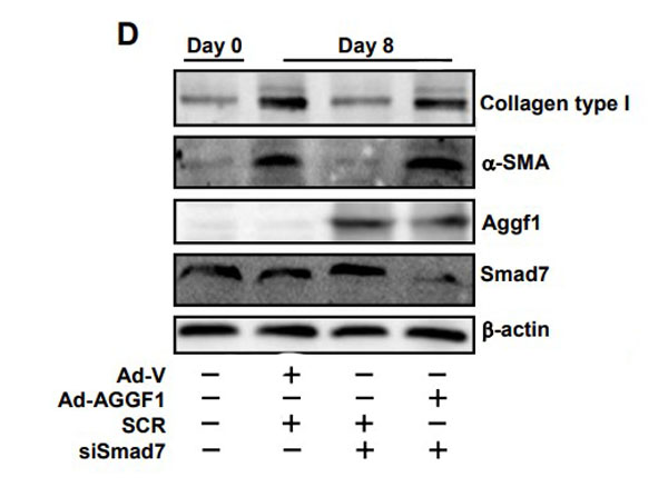 Aggf1 interacts with and modulates SMAD7 activity.
(D) Primary HSCs were infected with Ad-V or Ad-AGGF1 and then transfected with either siRNA targeting SMAD7 or scrambled siRNA (SCR). Expression of fibrogenic genes was examined by Western and qPCR (not shown). Figure 4. PMID: 26850475.
