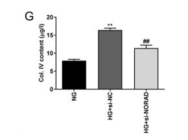 Knockdown of NORAD inhibits proliferation, inflammation and fibrosis in HG-induced HMCs. Levels of (G) Col. IV in HMCs measured via ELISA. **P