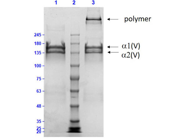 SDS-PAGE of Human Collagen Type V. Lane 1: Human Collagen Type V Reduced (7.0µg).  Lane 2: Opal Prestained Molecular Weight Marker (p/n MB-210-0500).  Lane 3: Human Collagen Type V Non-Reduced (7.0µg).  Observed MW: α1 and α2 bands. 4-20% Gel Coomassie Stained.