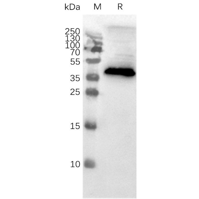CCR8 Human Recombinant Protein, Membrane Nanoparticle