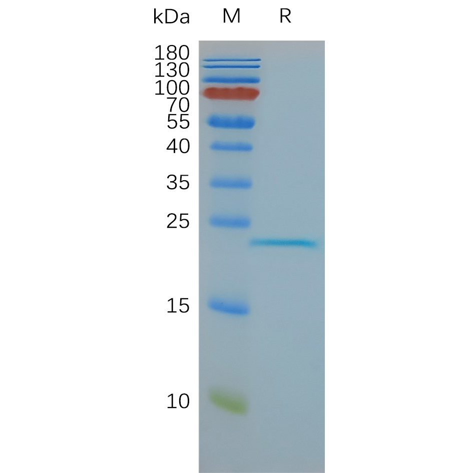 CLDN6 Human Recombinant Protein, Synthetic Nanodisc