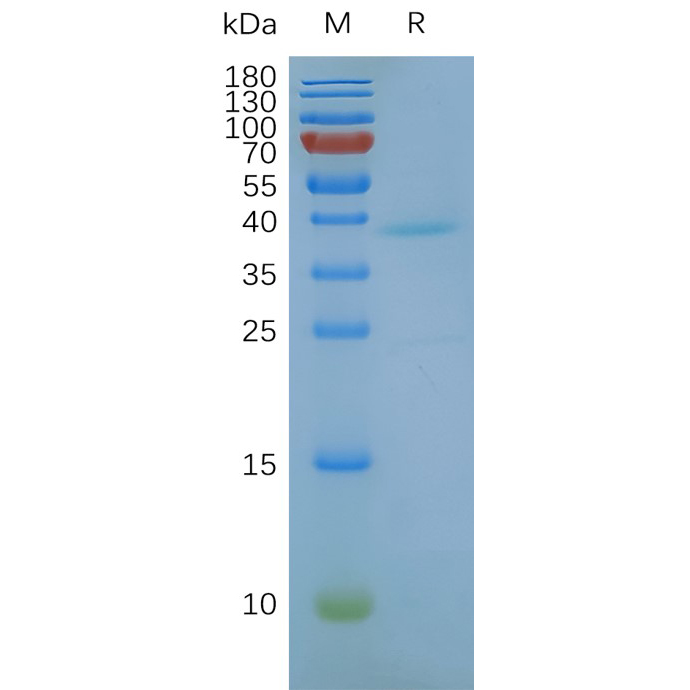 GPRC5D Human Recombinant Protein, Synthetic Nanodisc
