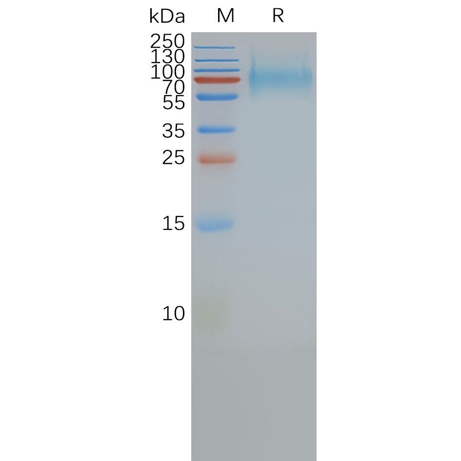 SSTR2 Human Recombinant Protein, Synthetic Nanodisc