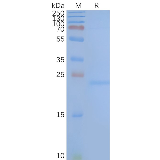 TM4SF1 Human Recombinant Protein, Synthetic Nanodisc