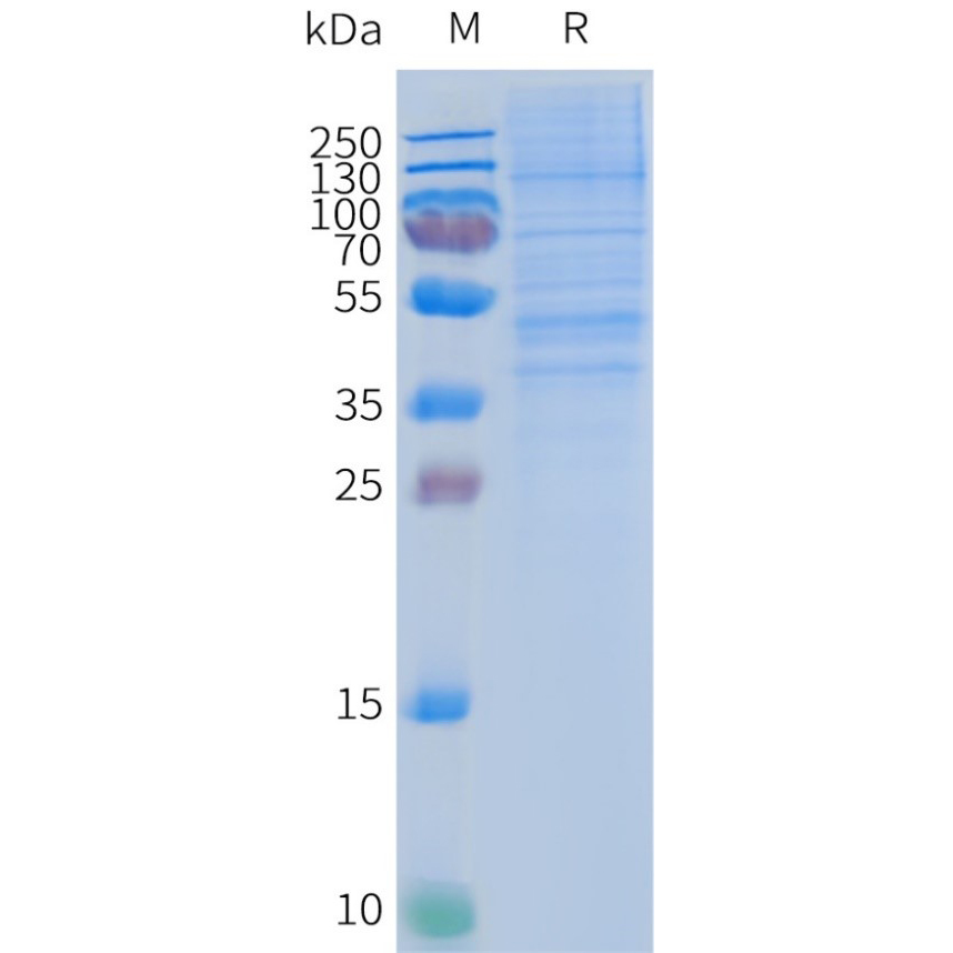 CCR2 Human Recombinant Protein, Synthetic Nanodisc