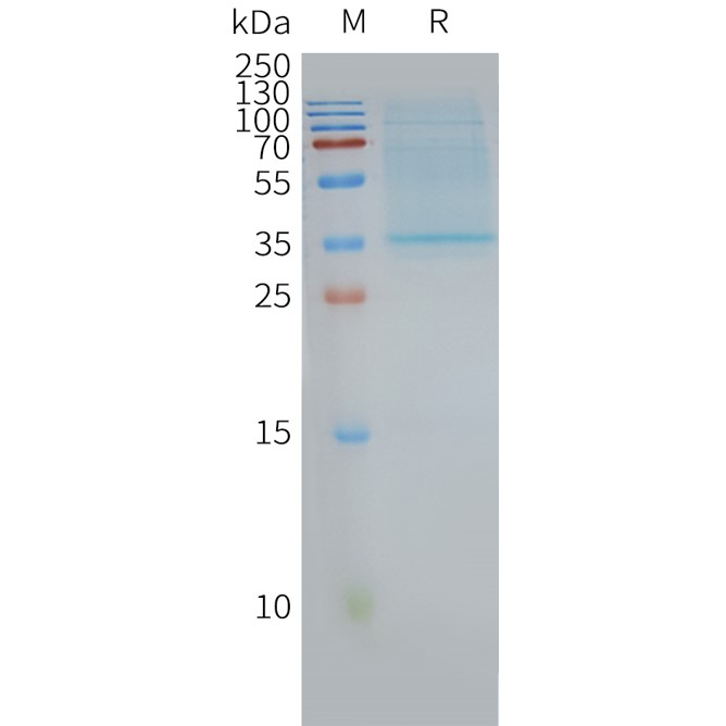 CD63 Human Recombinant Protein, Synthetic Nanodisc