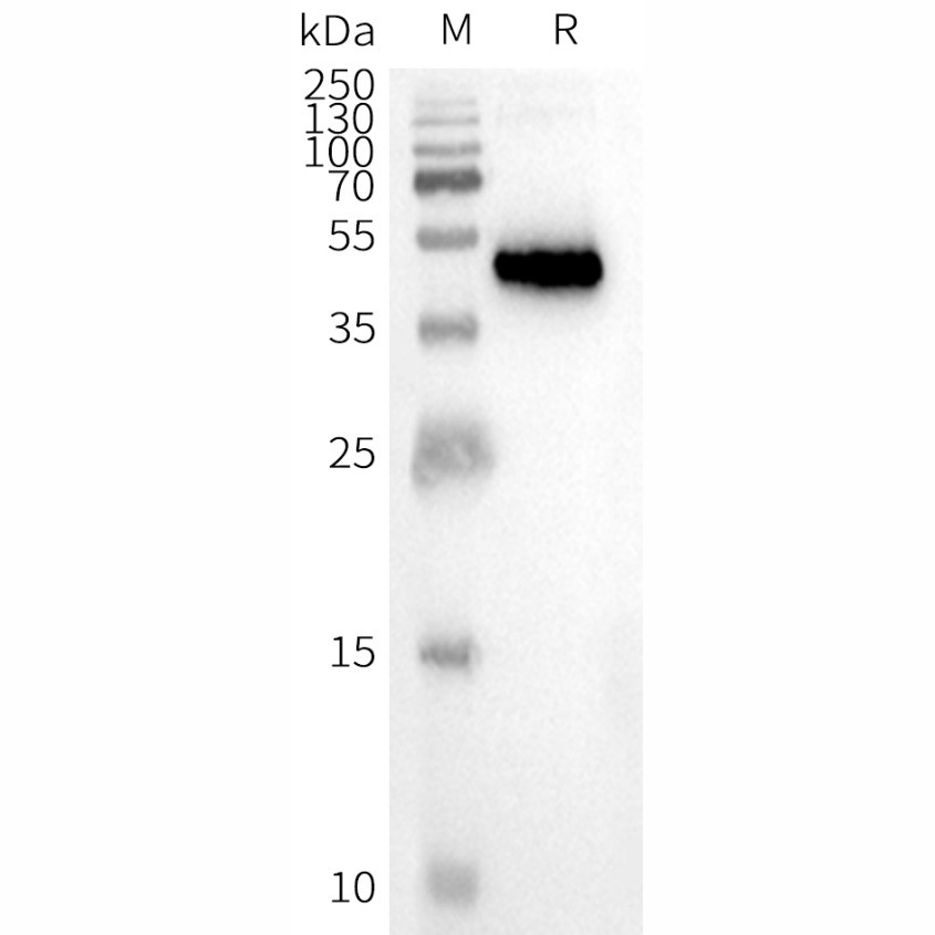 CCR8 Human Recombinant Protein, Synthetic Nanodisc