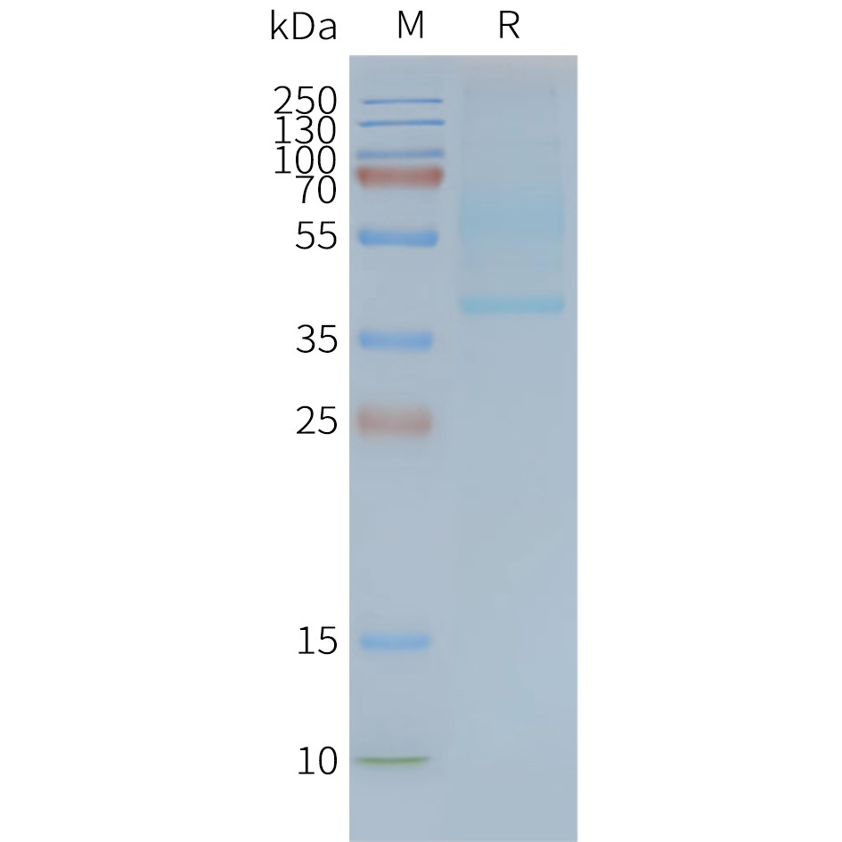 CD47 Human Recombinant Protein, Synthetic Nanodisc
