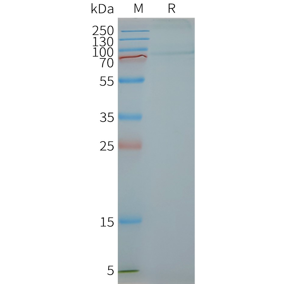 FSHR Human Recombinant Protein, Synthetic Nanodisc