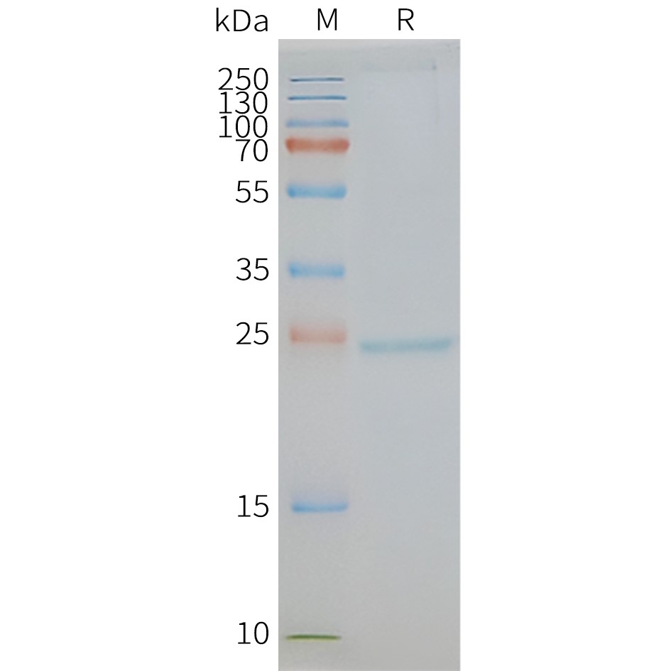 CD81 Human Recombinant Protein, Synthetic Nanodisc