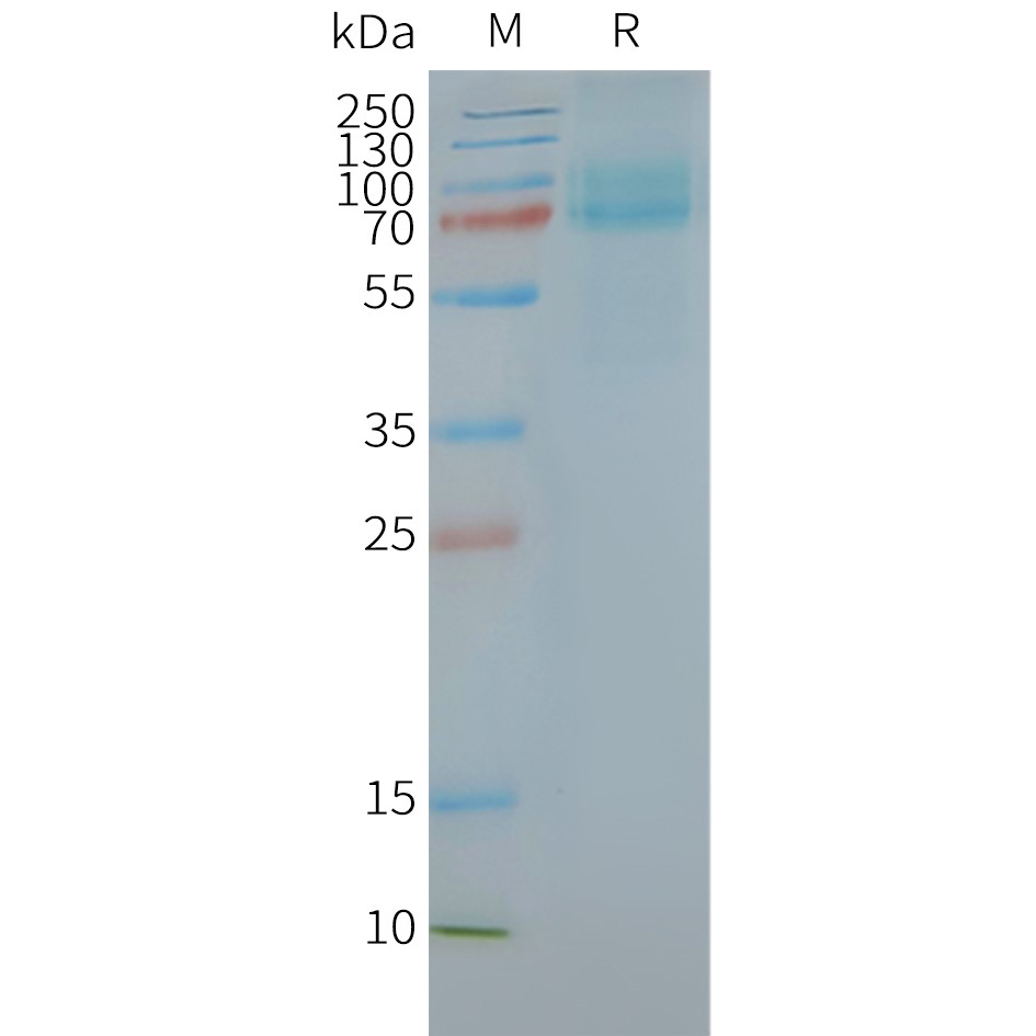 FZD10 Human Recombinant Protein, Synthetic Nanodisc