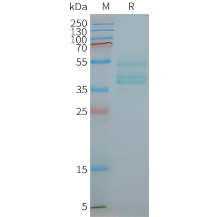 CCR6 Human Recombinant Protein, Synthetic Nanodisc