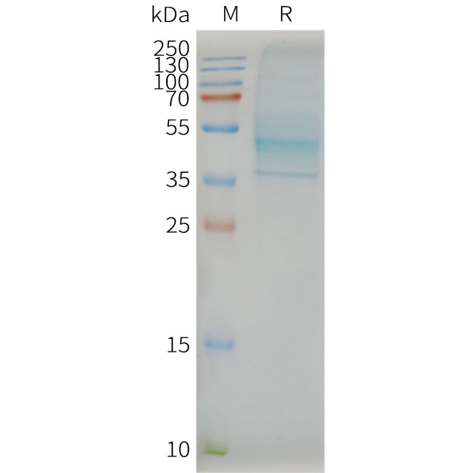 CCR7 Human Recombinant Protein, Synthetic Nanodisc