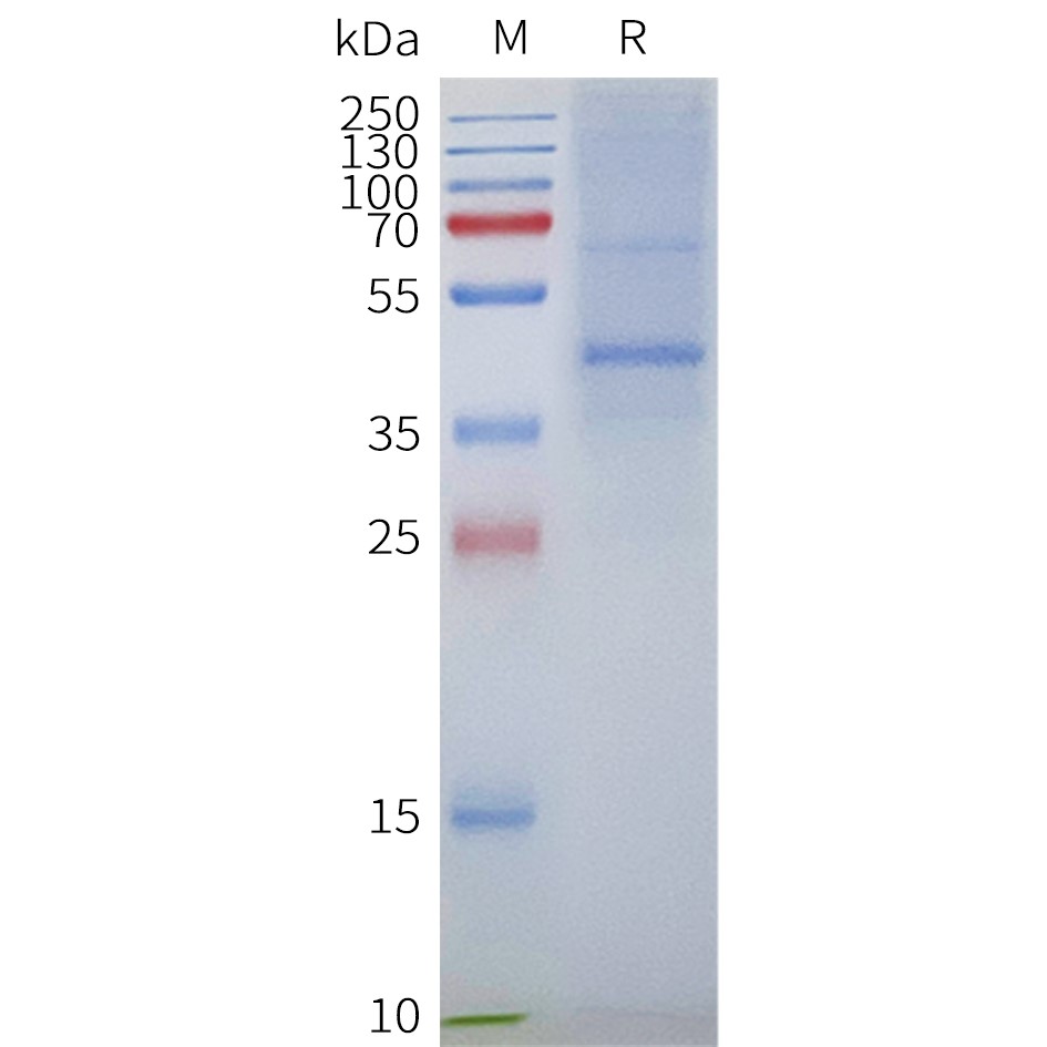 GPR87 Human Recombinant Protein, Synthetic Nanodisc