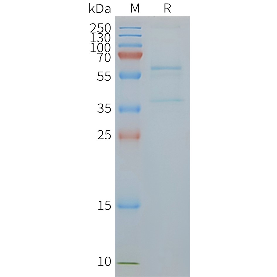 SLC2A4 Human Recombinant Protein, Synthetic Nanodisc