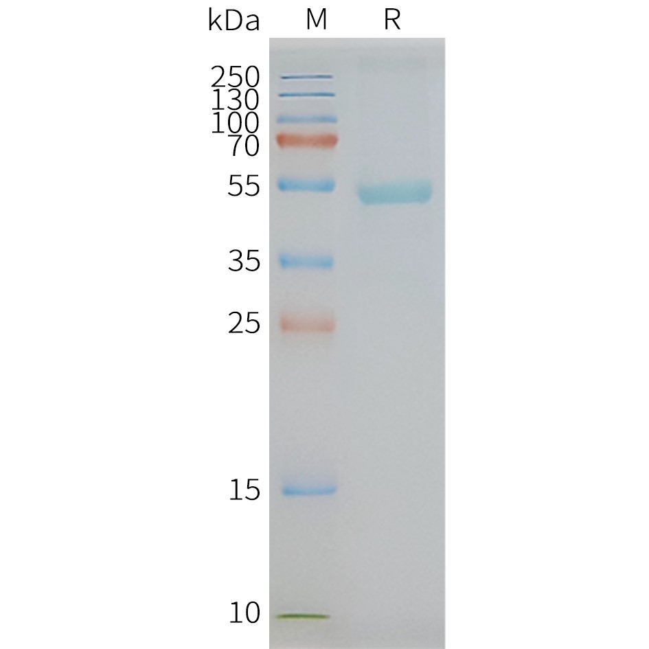 C5AR2 Human Recombinant Protein, Synthetic Nanodisc
