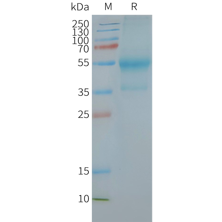 CXCR4 Human Recombinant Protein, Synthetic Nanodisc