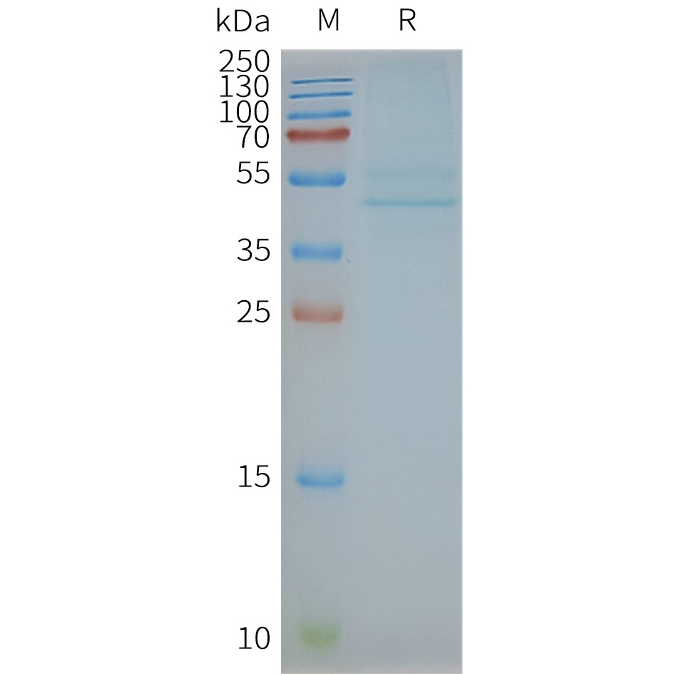 CCR3 Human Recombinant Protein, Synthetic Nanodisc