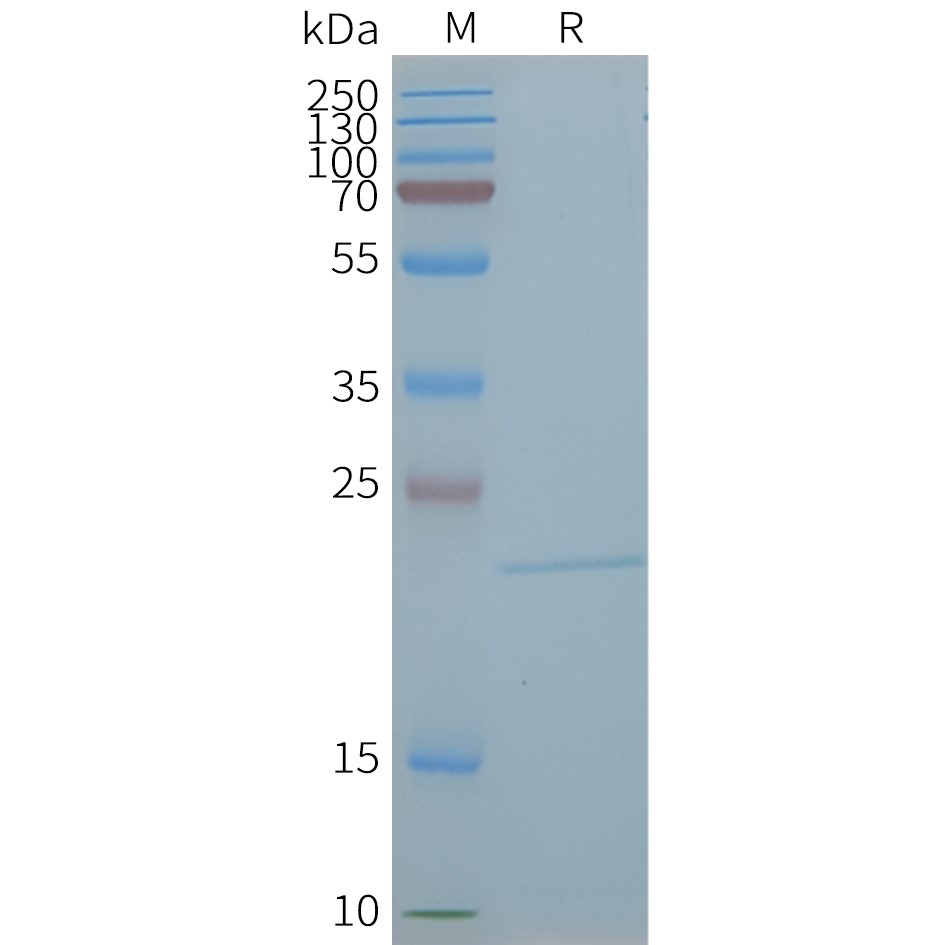 CLDN5 Human Recombinant Protein, Synthetic Nanodisc