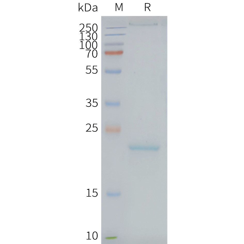 CLDN9 Human Recombinant Protein, Synthetic Nanodisc
