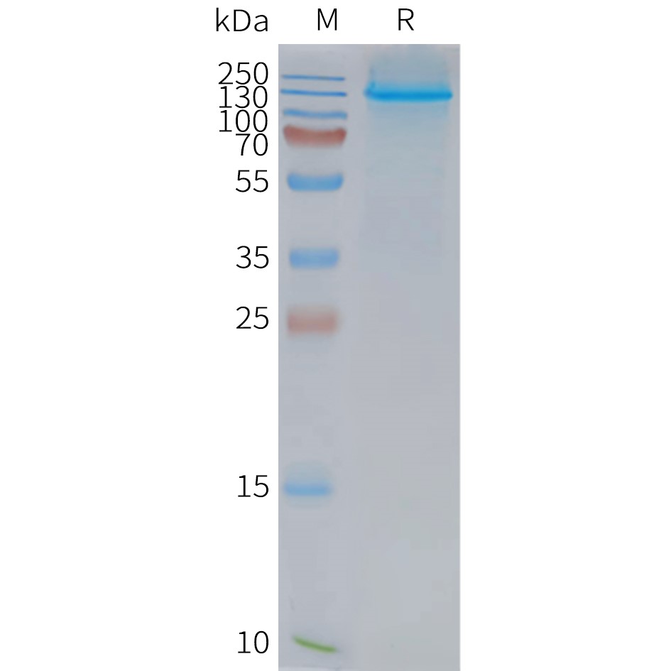 Figure 2. Human NPC1L1-Nanodisc, Flag Tag on SDS-PAGE