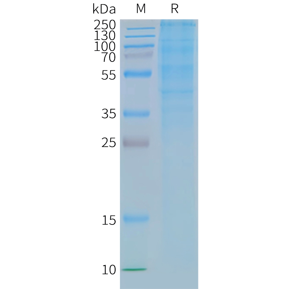 GLP1R Human Recombinant Protein, Synthetic Nanodisc