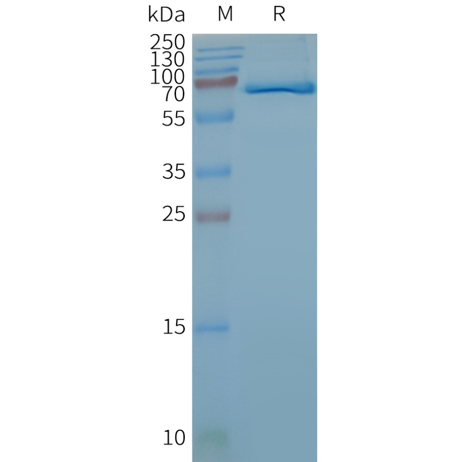 Figure 2. Human FZD4-Nanodisc, Flag Tag on SDS-PAGE