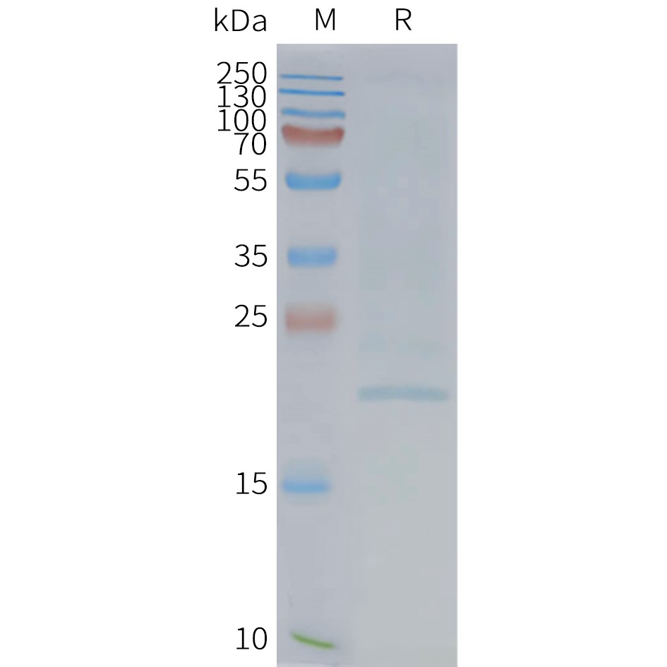 Figure 2. Human EMP2-Nanodisc, Flag Tag on SDS-PAGE