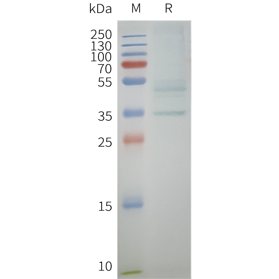 CCR10 Human Recombinant Protein, Synthetic Nanodisc
