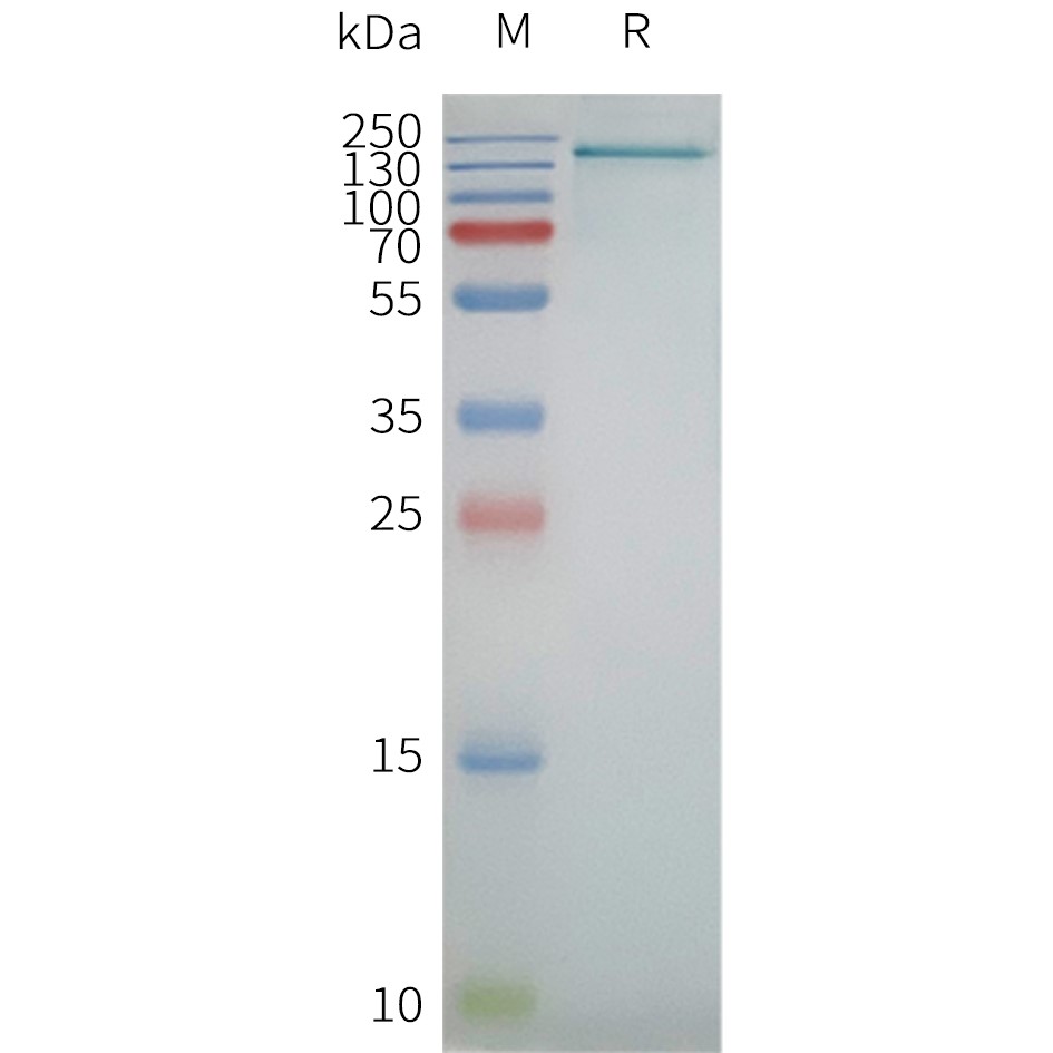 Figure 2. Human SCAP-Nanodisc, Flag Tag on SDS-PAGE