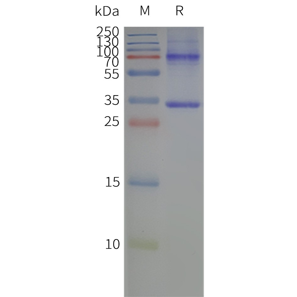 Figure 2. Human AQP4-M1-Nanodisc, Flag Tag on SDS-PAGE
