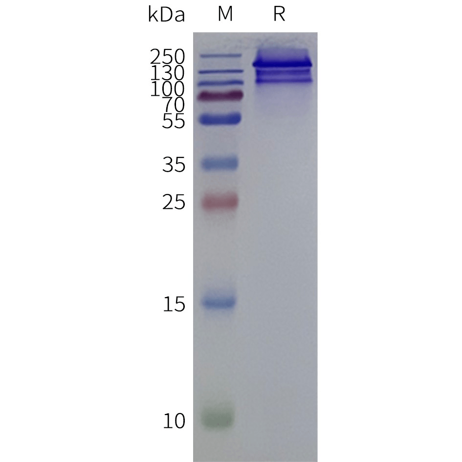 Figure 2. Human SLC4A3-Strep-Nanodisc, C-Flag&Strep Tag on SDS-PAGE