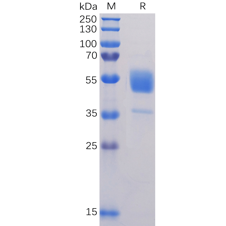 Figure 1. Human CD37 Protein, hFc Tag on SDS-PAGE under reducing condition.