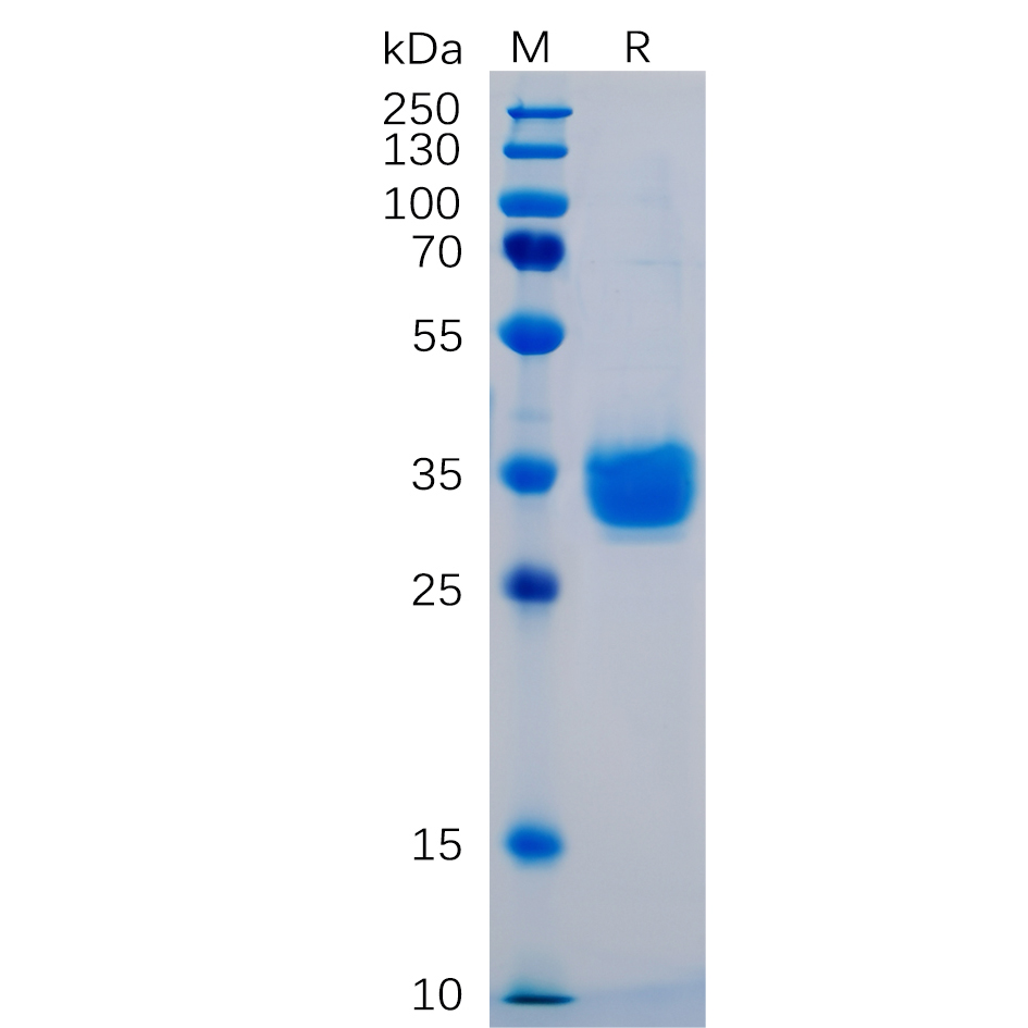 Figure 1. Human PD-L1 Protein, His Tag on SDS-PAGE under reducing condition.