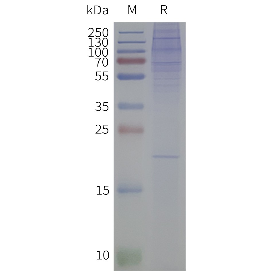 Figure 2. Human C3AR1-Strep-Nanodisc, C-Flag&Strep Tag on SDS-PAGE