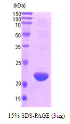 3ug by SDS-PAGE under reducing condition and visualized by coomassie blue stain.
