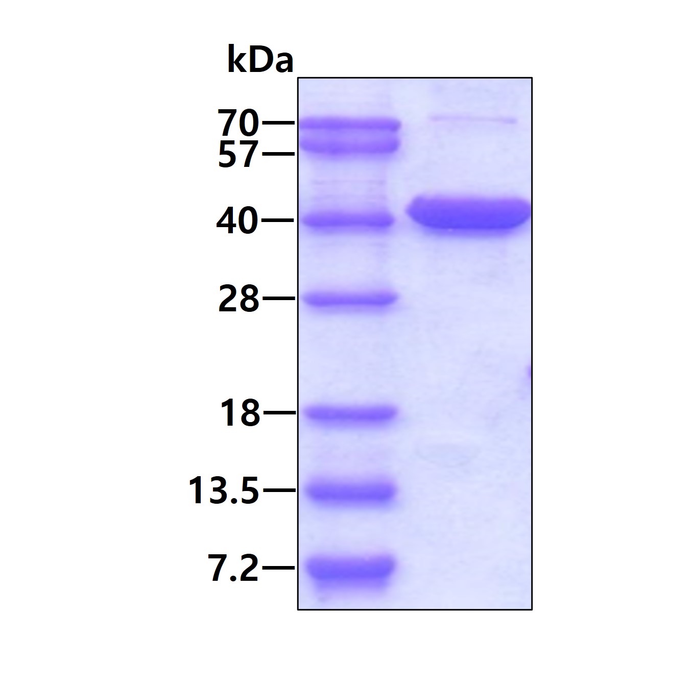 3ug by SDS-PAGE under reducing condition and visualized by coomassie blue stain.
