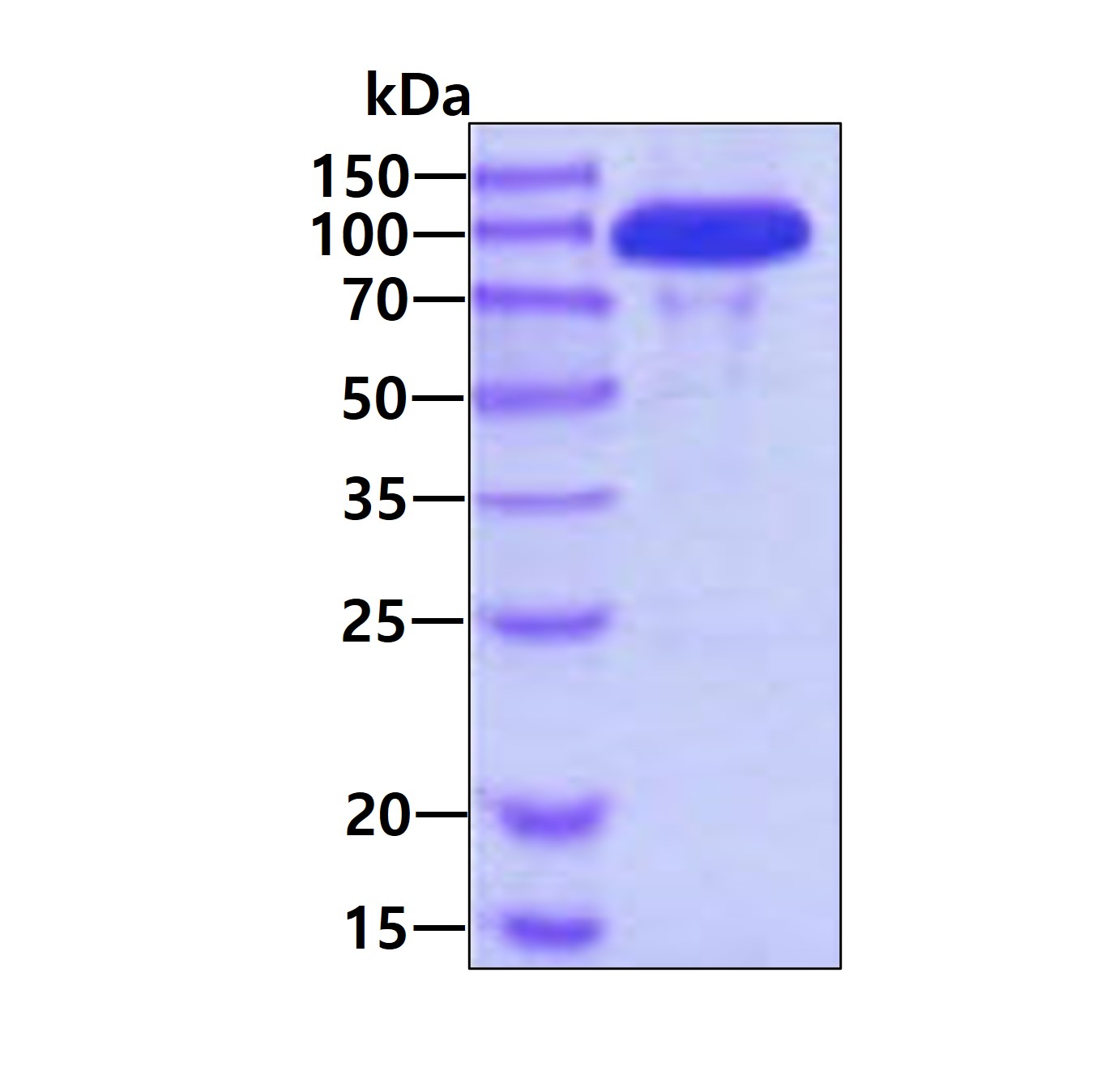 3ug by SDS-PAGE under reducing condition and visualized by coomassie blue stain.