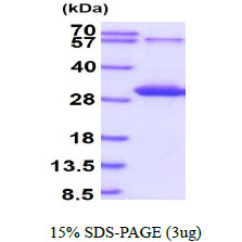 3ug by SDS-PAGE under reducing condition and visualized by coomassie blue stain.