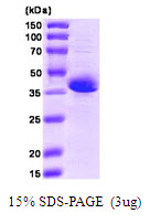 3ug by SDS-PAGE under reducing condition and visualized by coomassie blue stain.
