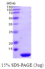 3ug by SDS-PAGE under reducing condition and visualized by coomassie blue stain.