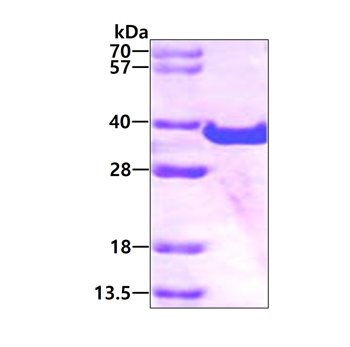 3ug by SDS-PAGE under reducing condition and visualized by coomassie blue stain.