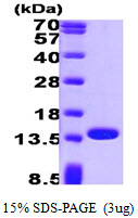 3ug by SDS-PAGE under reducing condition and visualized by coomassie blue stain.