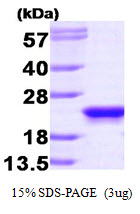 3ug by SDS-PAGE under reducing condition and visualized by coomassie blue stain.