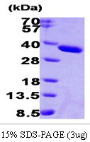 3ug by SDS-PAGE under reducing condition and visualized by coomassie blue stain.