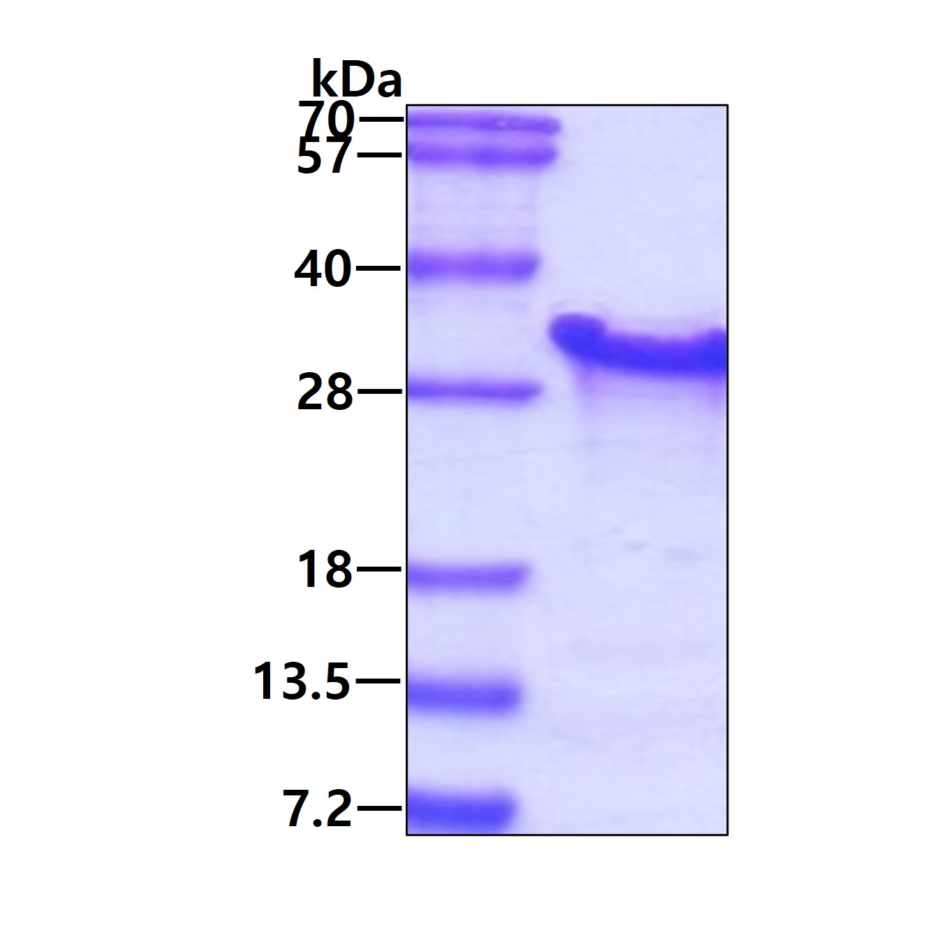 3ug by SDS-PAGE under reducing condition and visualized by coomassie blue stain