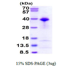 3ug by SDS-PAGE under reducing condition and visualized by coomassie blue stain.